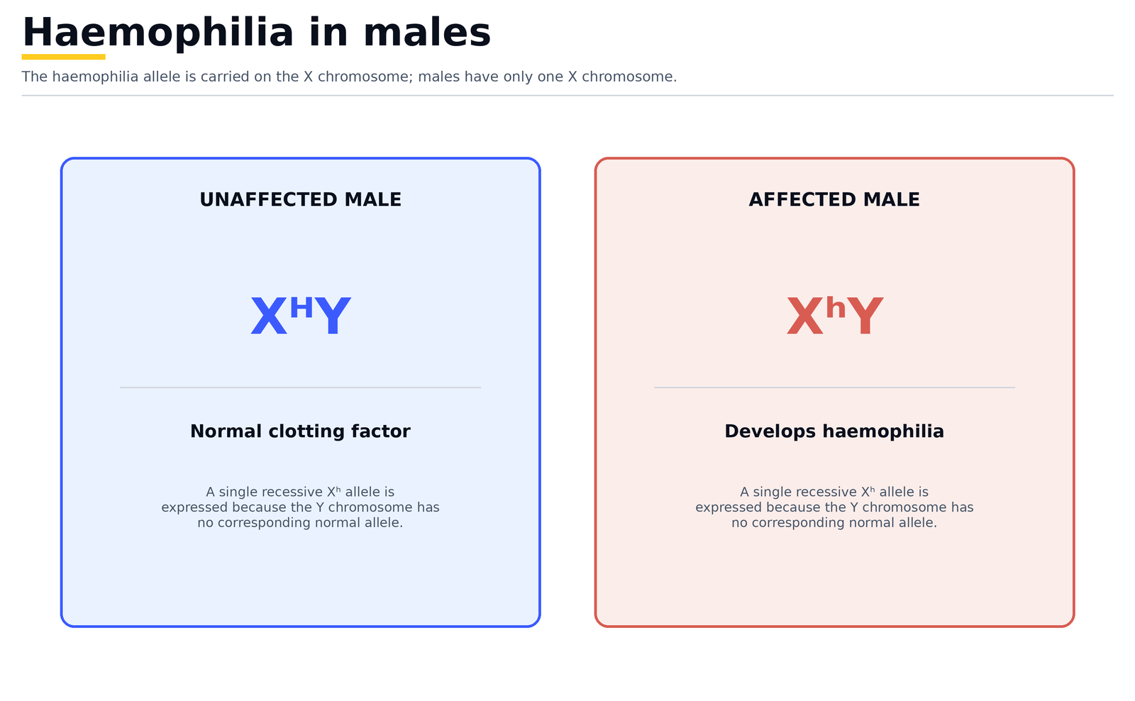 Haemophilia in males: an unaffected male is X^H Y with normal clotting factor, while an affected male is X^h Y because there is no second X to mask the recessive allele