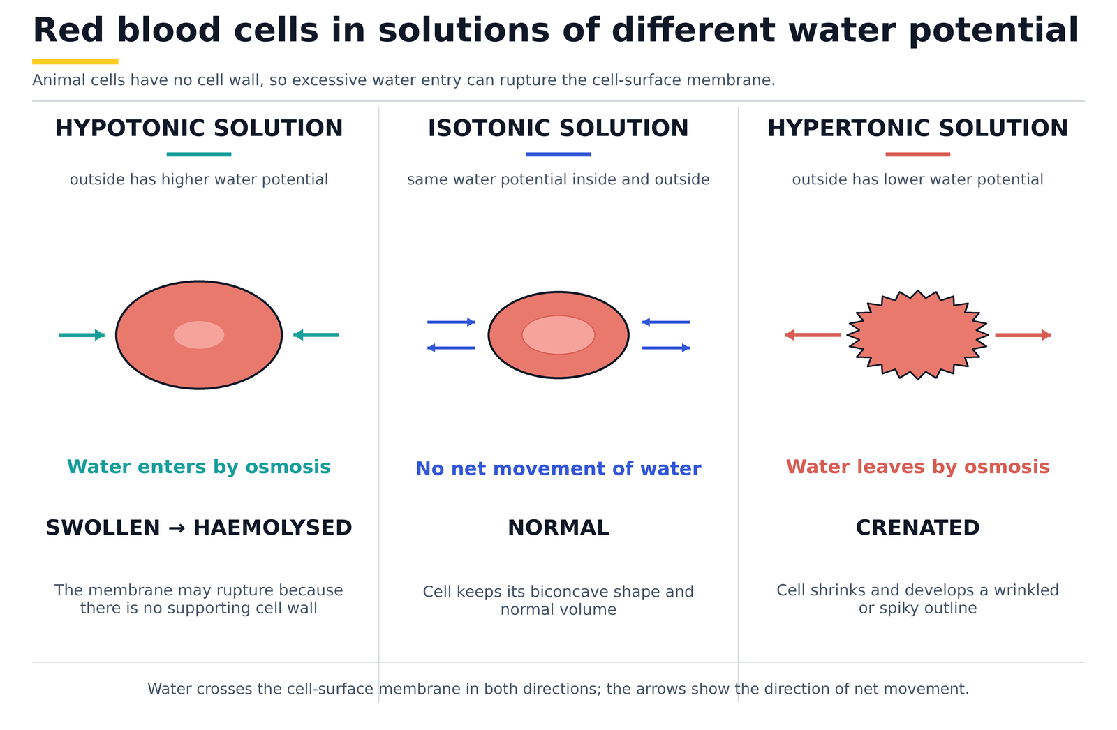 Red blood cells in solutions of different water potential: swollen and haemolysed in a hypotonic solution, normal in an isotonic solution, and crenated in a hypertonic solution
