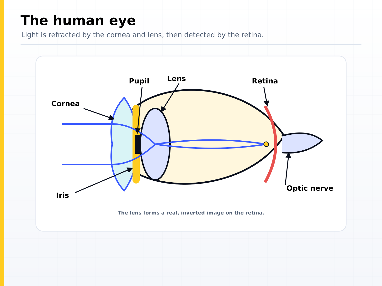 The human eye: light is refracted by the cornea and the lens, passes the iris and pupil, and forms a real inverted image on the retina which the optic nerve carries to the brain